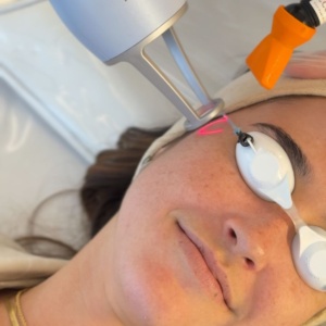 lavieen laser