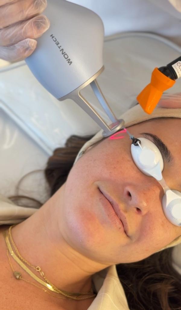 lavieen laser