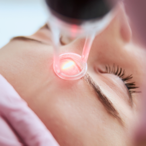 Lavieen Laser